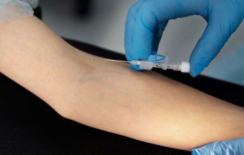 terapia endovenosa